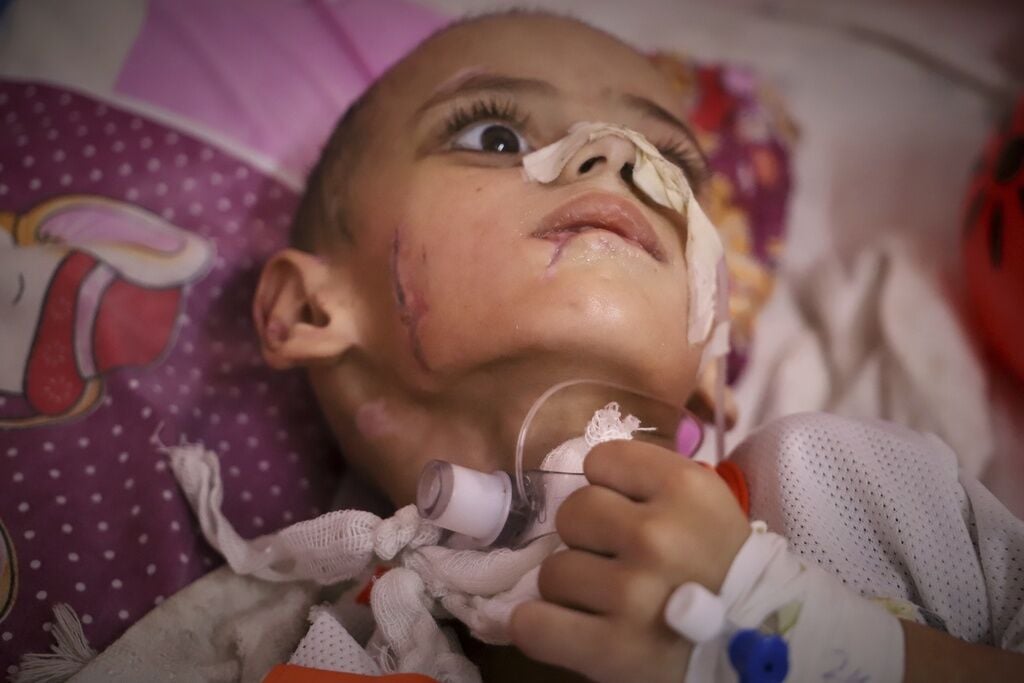 Mideast Wars Gaza Children